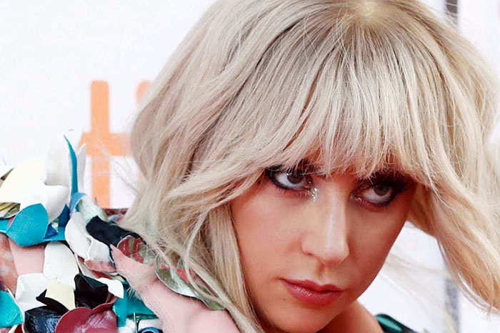 Lady Gaga revela que sofre de doença incurável