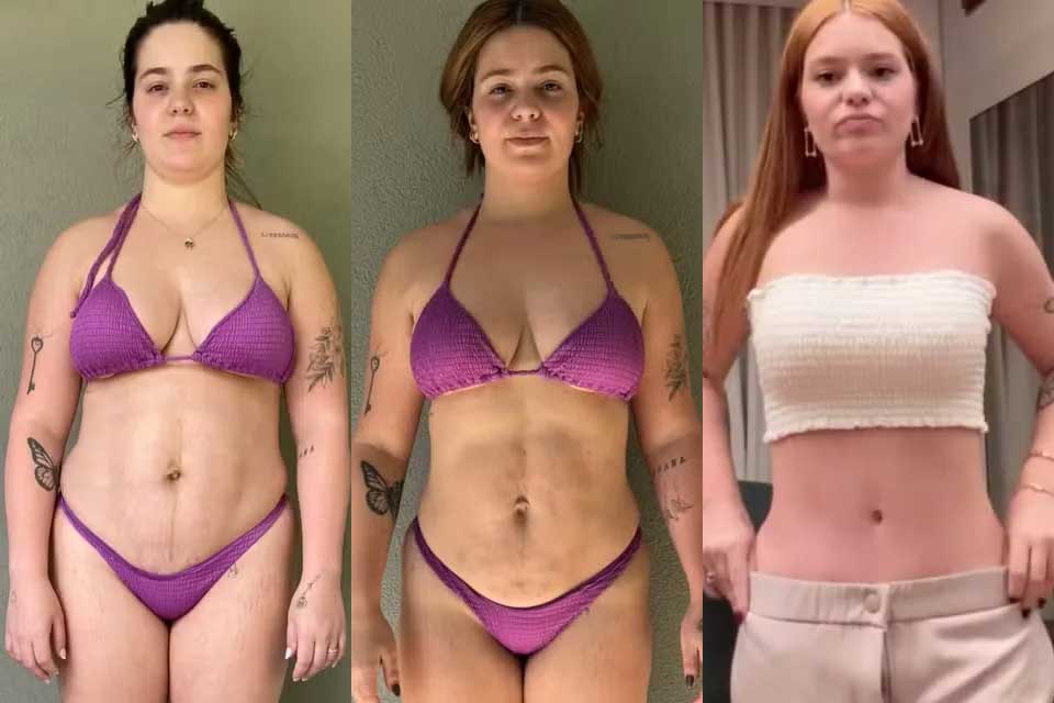 Cinco meses após cirurgias, Viih Tube exibe evolução e comemora resultado