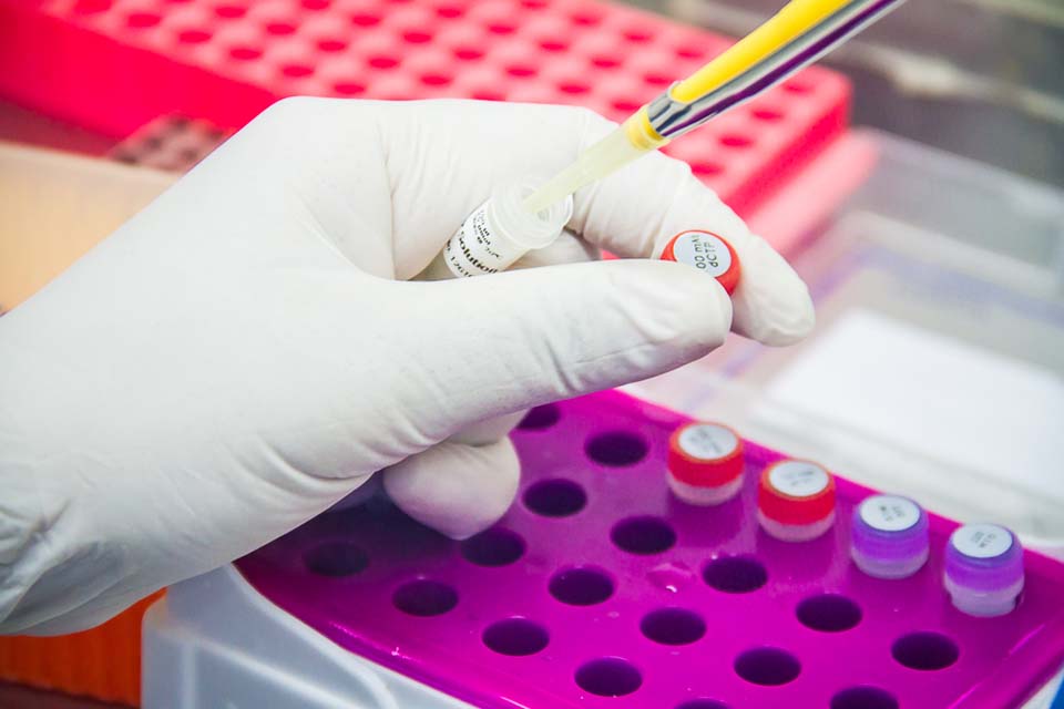 Governo de Rondônia cria Comitê de Enfrentamento ao Coronavírus; é preciso que a estrutura governamental tenham uma estratégia