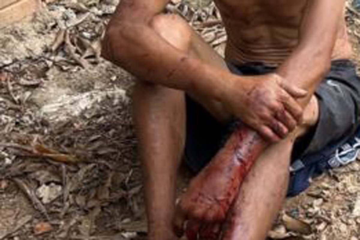 Homem é espancado por criminosos após cobrança de dívida em Porto Velho
