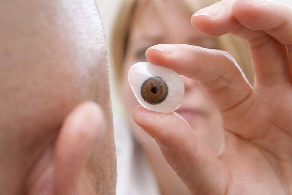 Homem vai receber primeira prótese ocular impressa em 3D