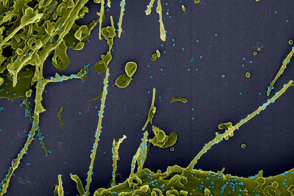 Covid-19: variante britânica não causa doença mais grave, diz estudo