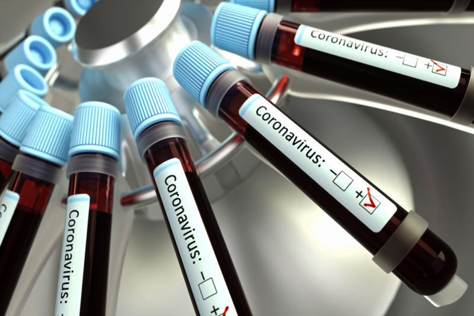 Estado tem 6 casos confirmados: notificações do Coronavírus em Rondônia - 13ª Edição