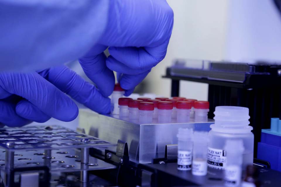 Município registrou uma morte e 123 novos casos de covid-19 no intervalo de 24 horas