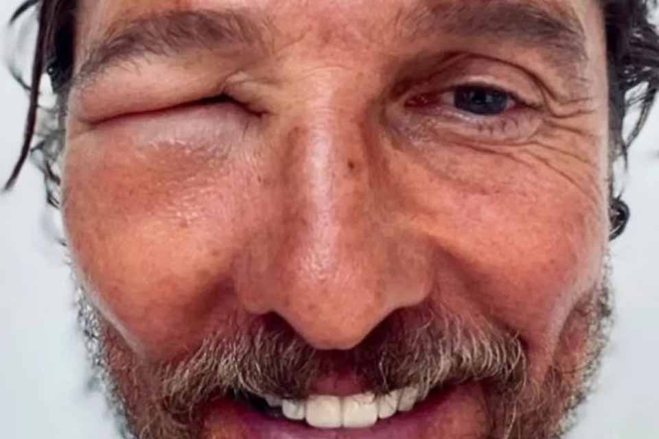 Matthew McConaughey surge irreconhecível e choca fãs: “Nada como uma picada de abelha para apimentar o dia!”