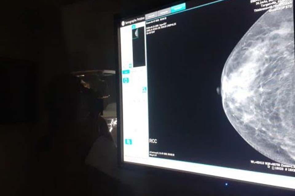 Prefeitura realizará cadastro para exames de mamografia no distrito Tarilândia nos dias 15 e 16 de dezembro