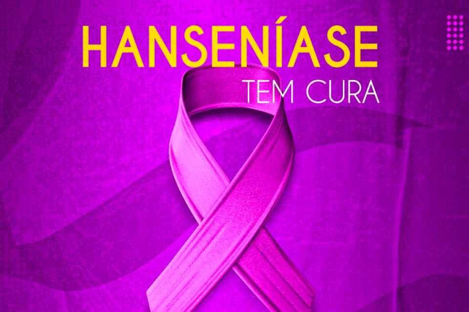 Prefeitura alerta a comunidade em mês da conscientização e combate à hanseníase