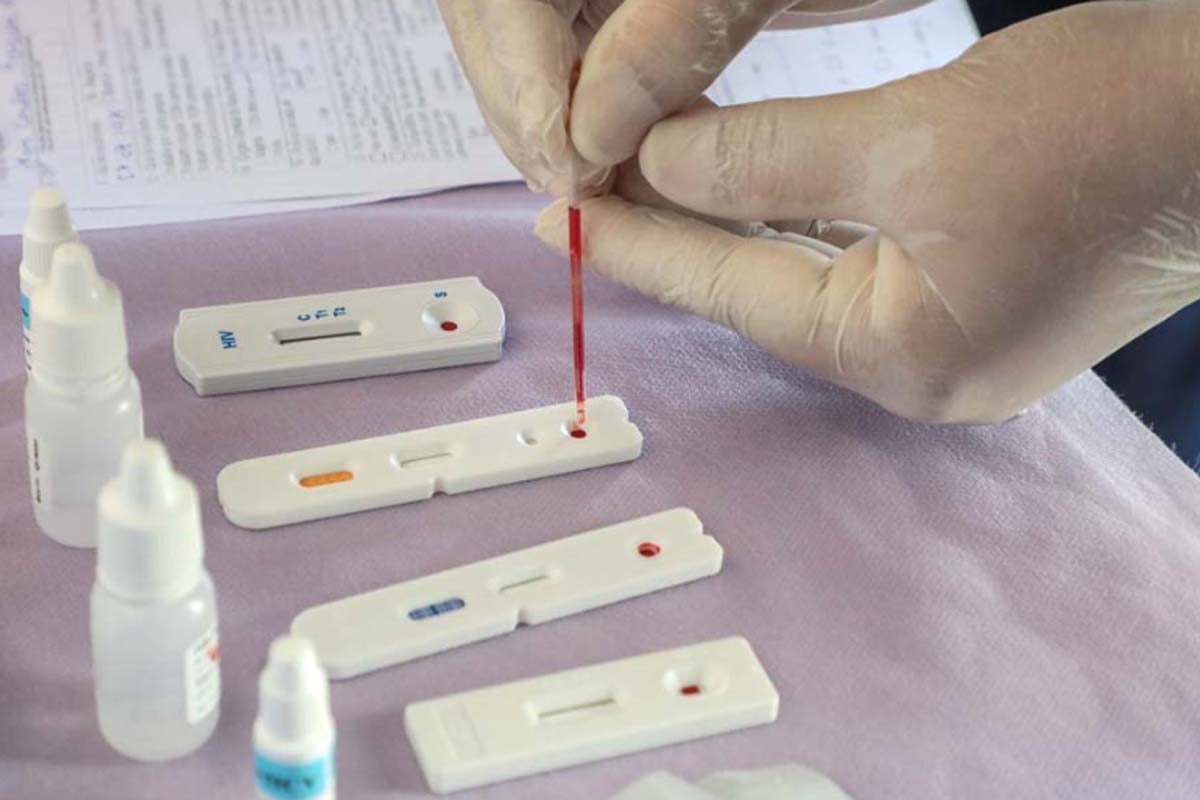 Estudo inédito da Fiocruz pode ampliar prevenção de HIV entre jovens