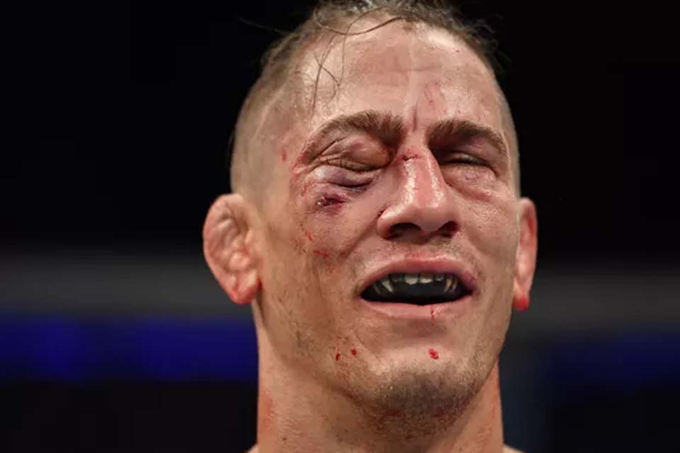 VÍDEO - Brasileiro Vicente Luque estraçalha rosto de americano, médico é acionado, e brasileiro vence no UFC 249