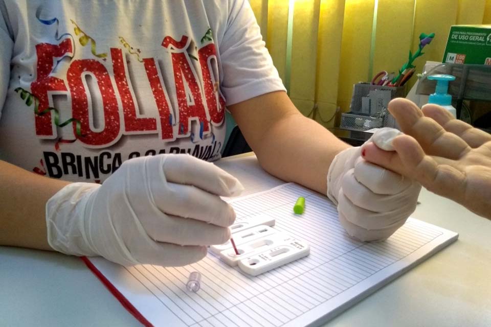 SAE/IST registra mais de 100 casos de HIV em 2019