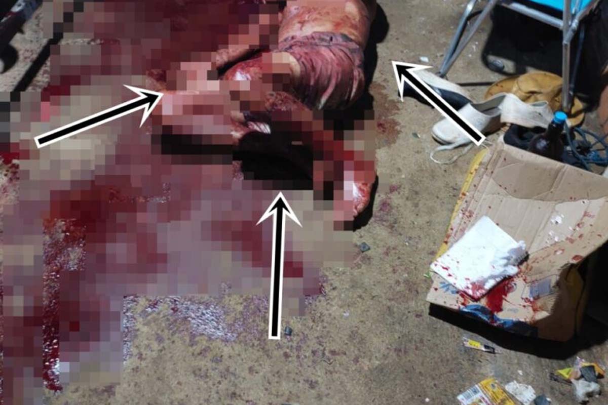  Morador ataca colega enquanto dormia com golpes de facão no Setor 06