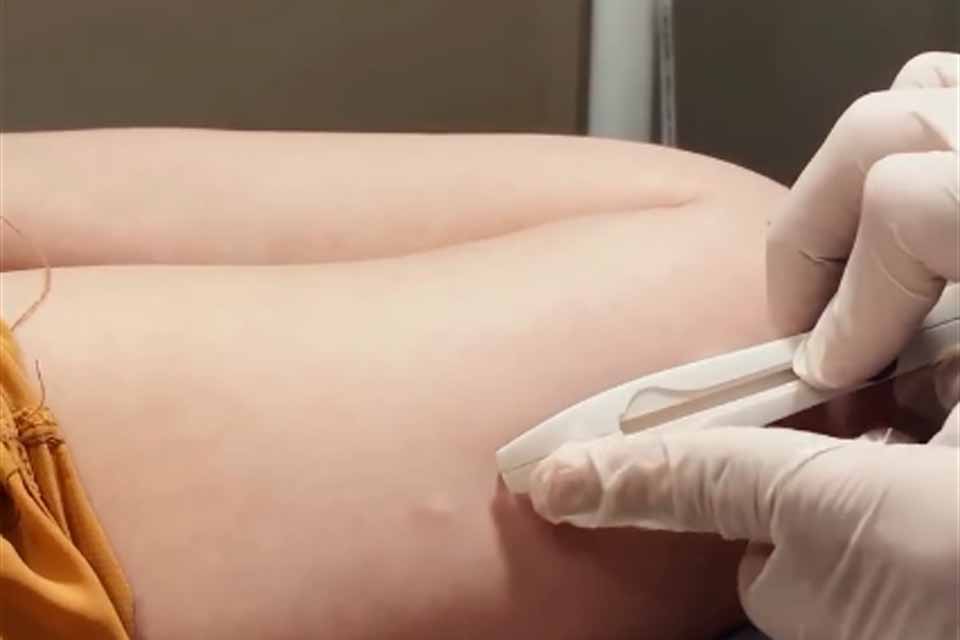 Ji-Paraná avança no cuidado com a saúde da mulher