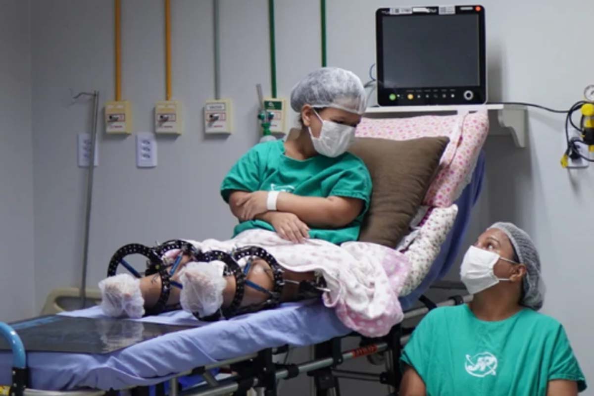 Tratamento inédito para nanismo na região Norte é realizado com investimentos do governo de RO