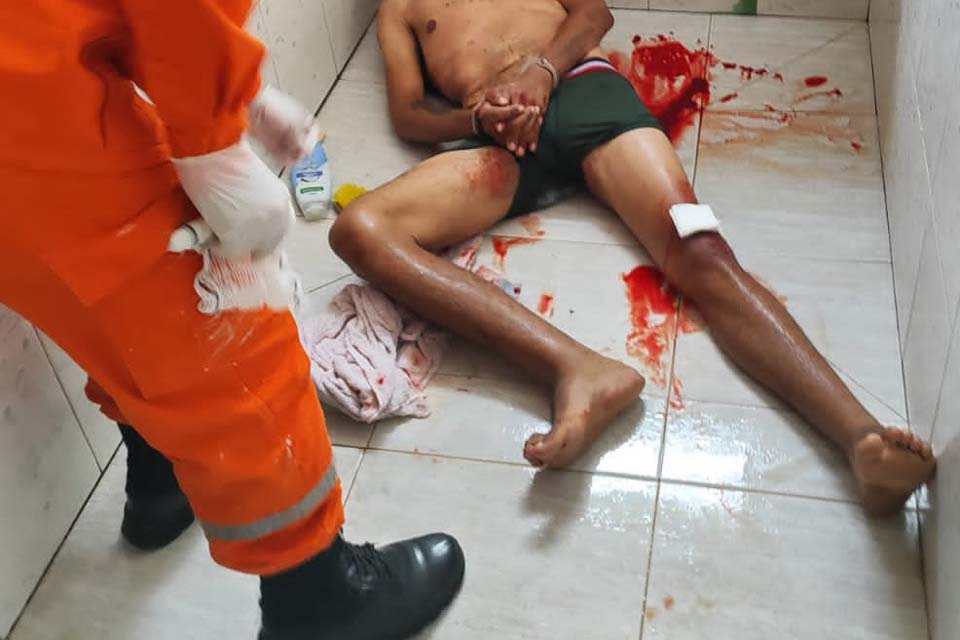 Bandido invade casa para furtar e é surpreendido com tiro na perna