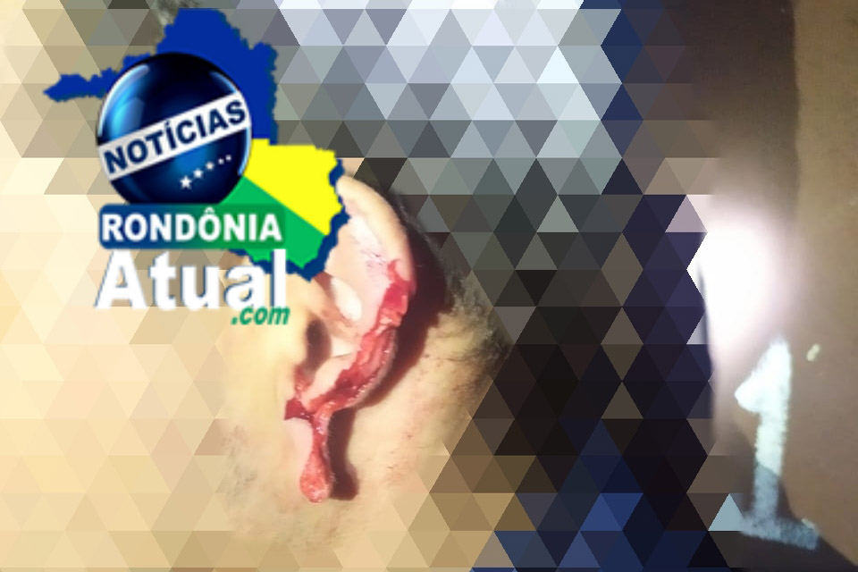 Homem arranca pedaço do nariz e orelha do namorado de sua ex