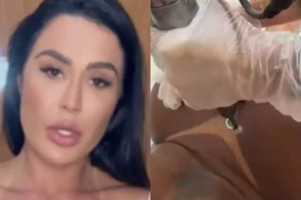 Gracyanne inicia remoção de tatuagem em homenagem a Belo: “Vida que segue”