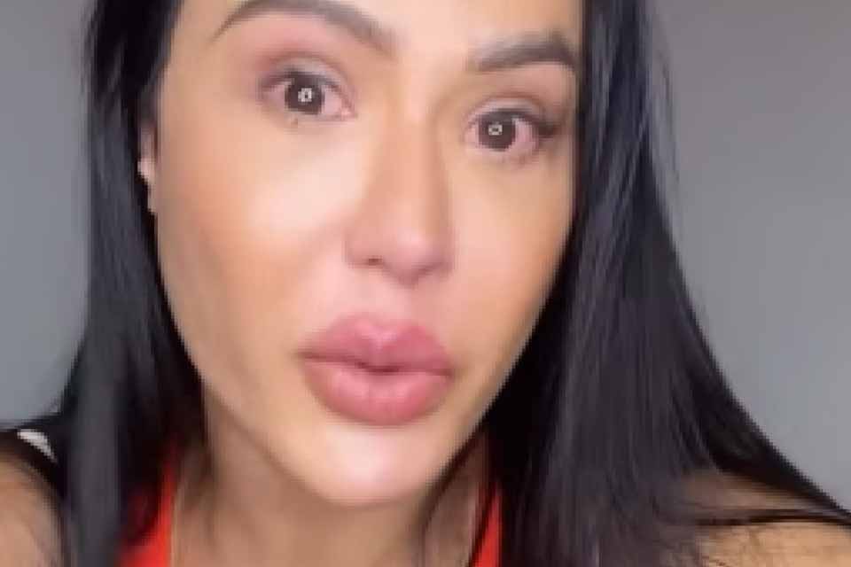 Gracyanne Barbosa se emociona ao falar sobre dores no joelho: “Estalo muito alto”
