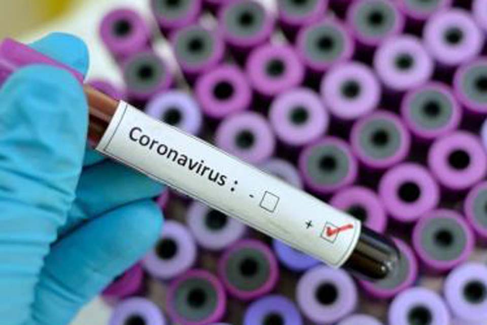 Município registra um óbito e 54 novos casos de covid-19 nas últimas 24 horas