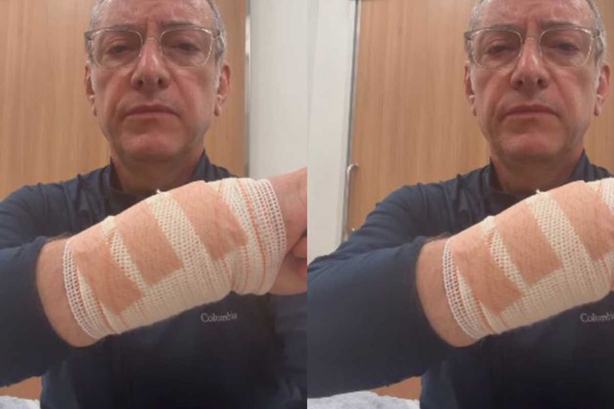“O preço da irresponsabilidade”: jornalista da Globo relata ataque de pitbull durante passeio