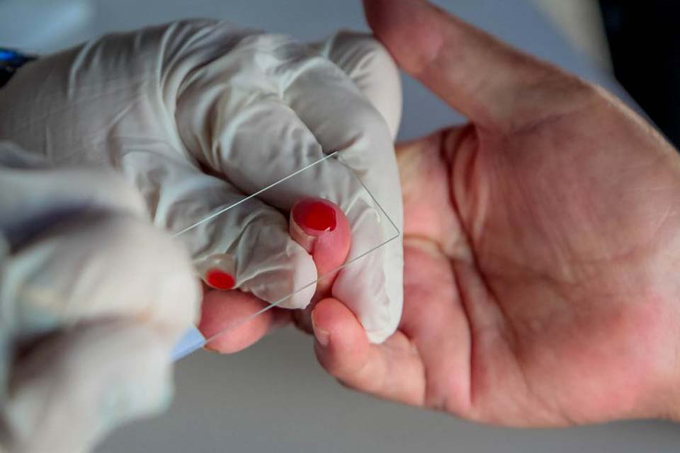 Estudo sobre a implantação de medicamento inovador no tratamento da malária tem participação do Centro de Pesquisa de Rondônia