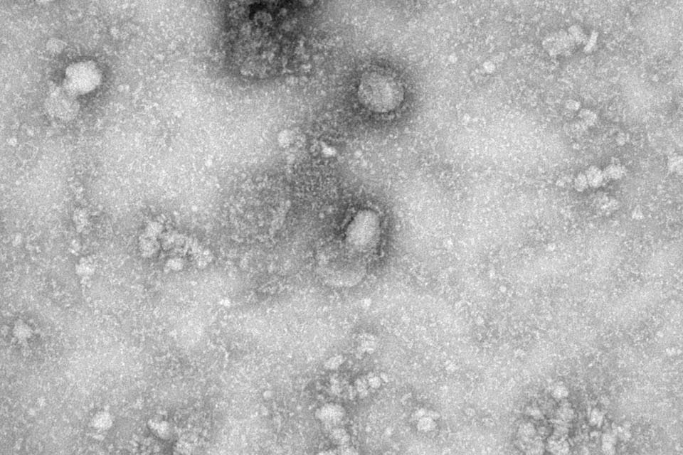 Número total de mortes em decorrência do coronavírus ultrapassa 360