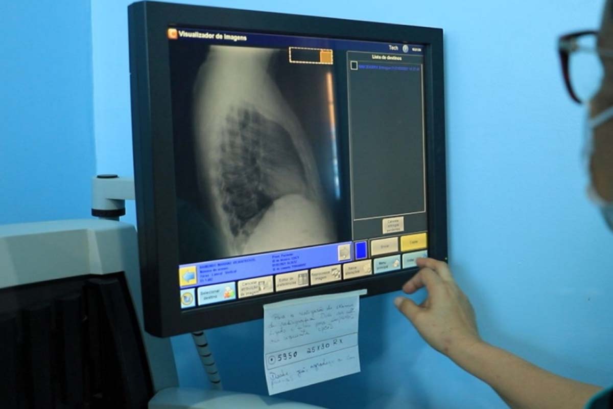 Prefeitura de Porto Velho alerta para prevenção e tratamento da tuberculose