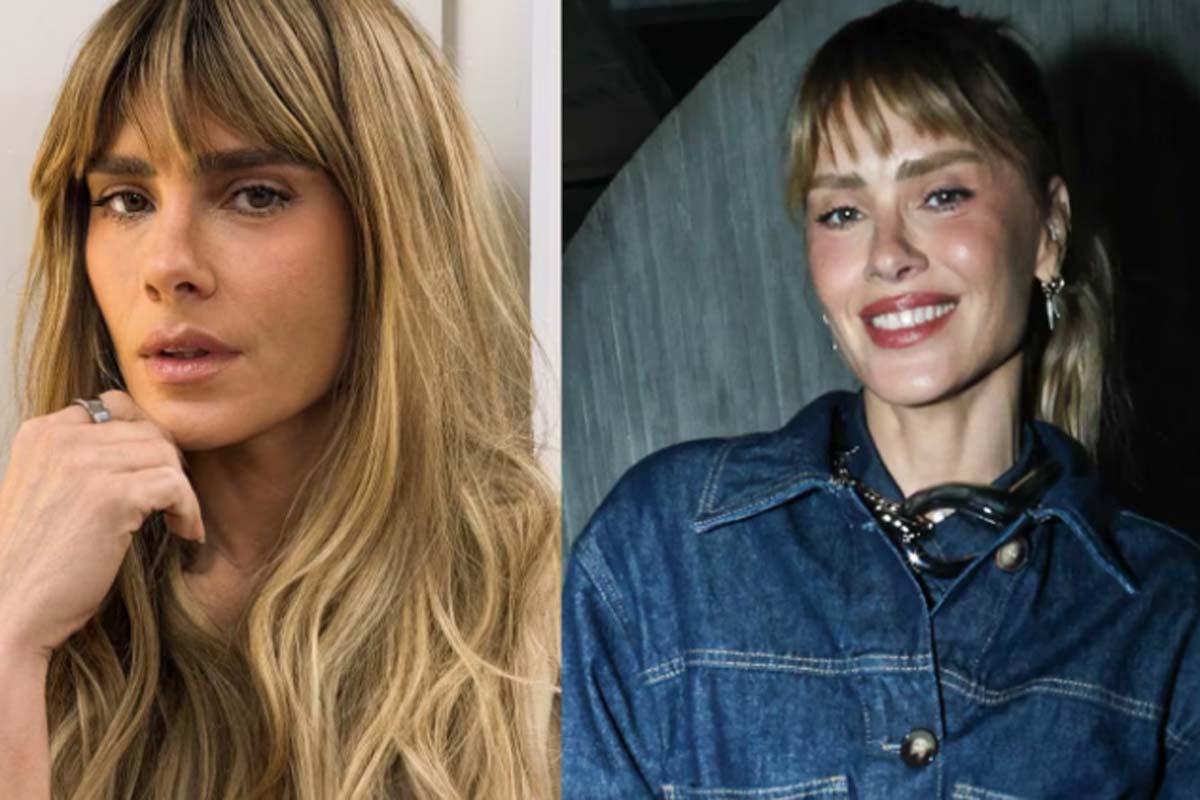 Carolina Dieckmmann mostra resultado de procedimento no rosto