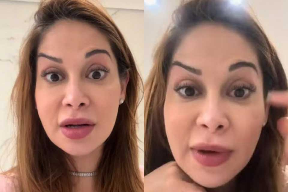 Maíra Cardi exibe rosto torto após botox: “Faz para ficar bonito e fica feio”