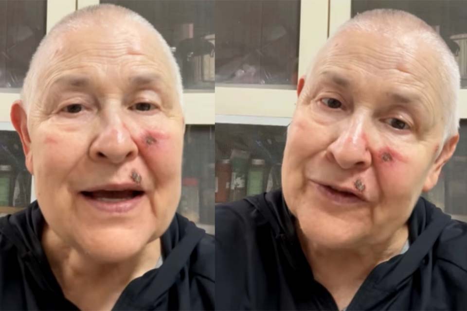 Monja Coen revela diagnóstico de câncer: 'Fiquem tranquilos'