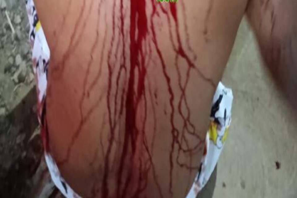 Polícia Militar é acionada após homem ser esfaqueado por ex-mulher 