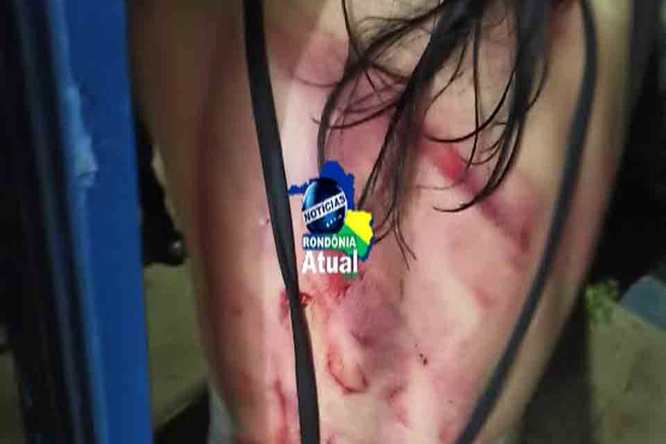 Mulher é brutalmente agredida a golpes de facão em Ji-Paraná