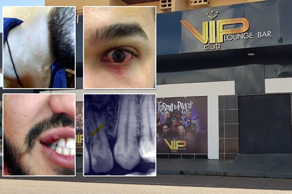 Espancamento VIP: vítima de homofobia apanha dentro e fora de boate em Porto Velho