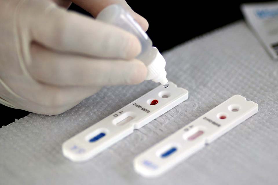 DF recebe 150 mil testes rápidos para detecção da covid-19