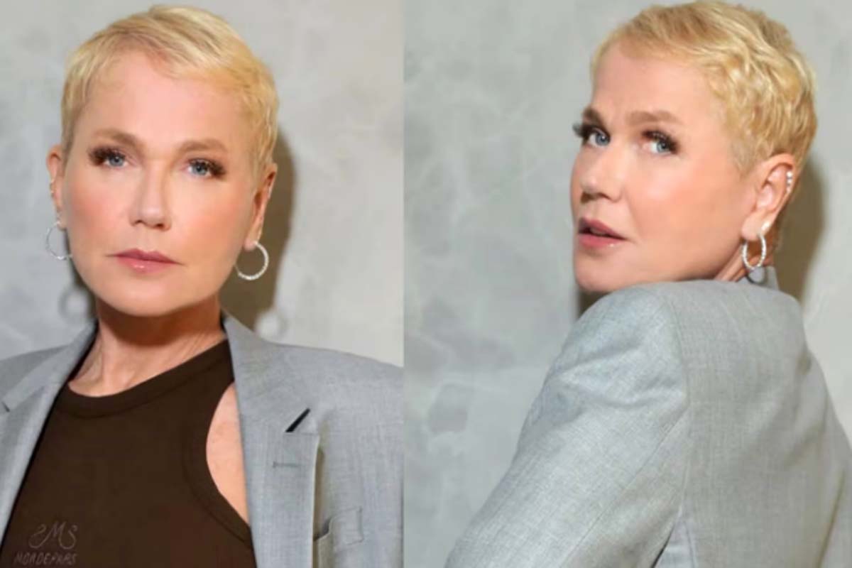 Xuxa mostra resultado de transplante capilar e fala sobre luta contra alopecia