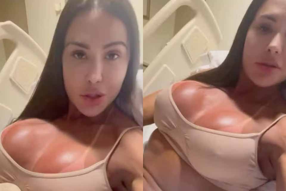 Gracyanne Barbosa mostra corpo inchado após lesão no “Dança dos Famosos”