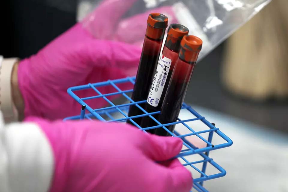 OMS vai disponibilizar 120 milhões de testes de Covid para 133 países