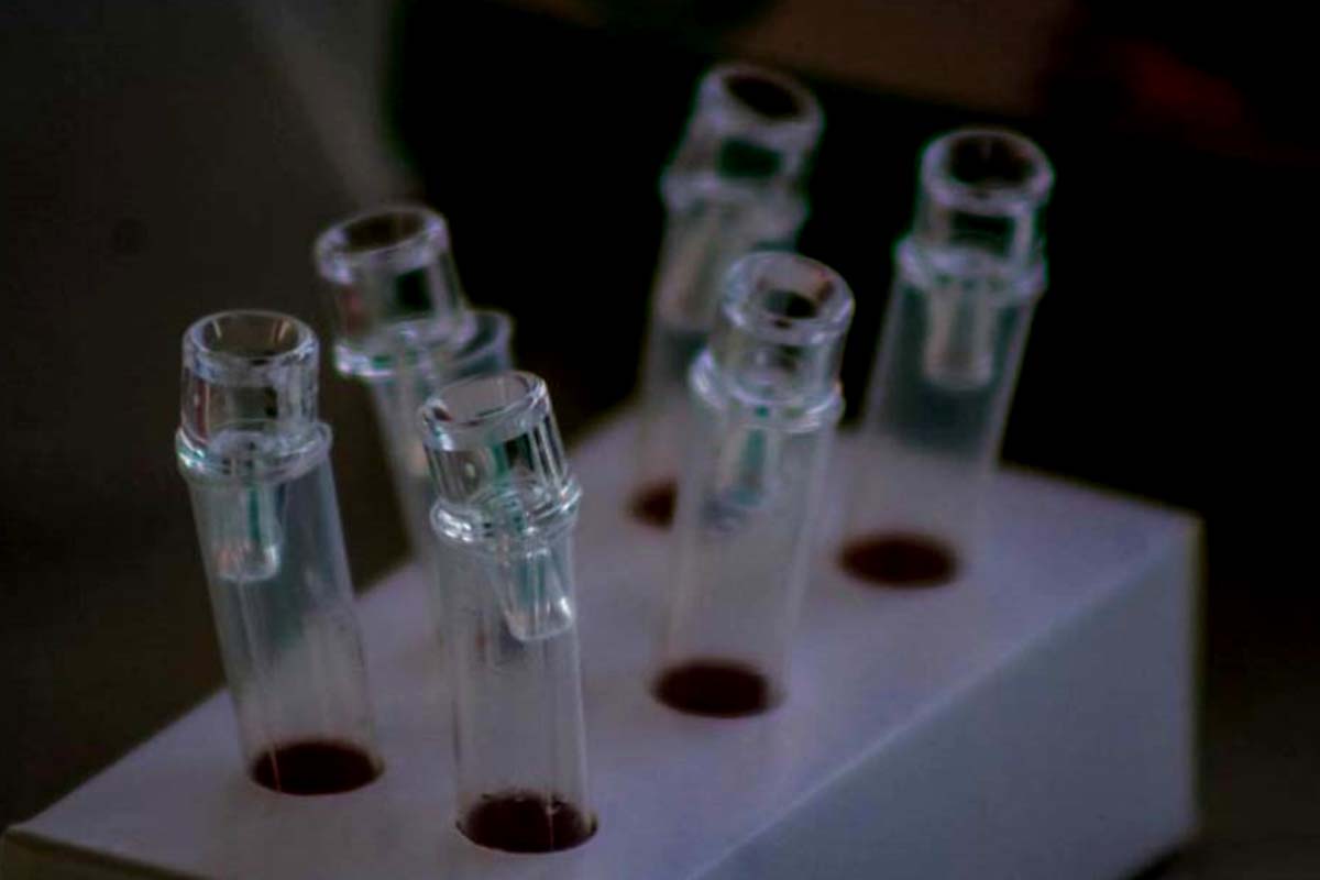 Desinformação sobre HIV dificulta tratamento e aumenta preconceito