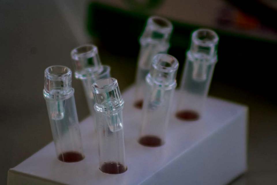 Secretária de Estado da Saúde orienta onde buscar diagnóstico e tratamento para HIV/Aids na rede pública de saúde