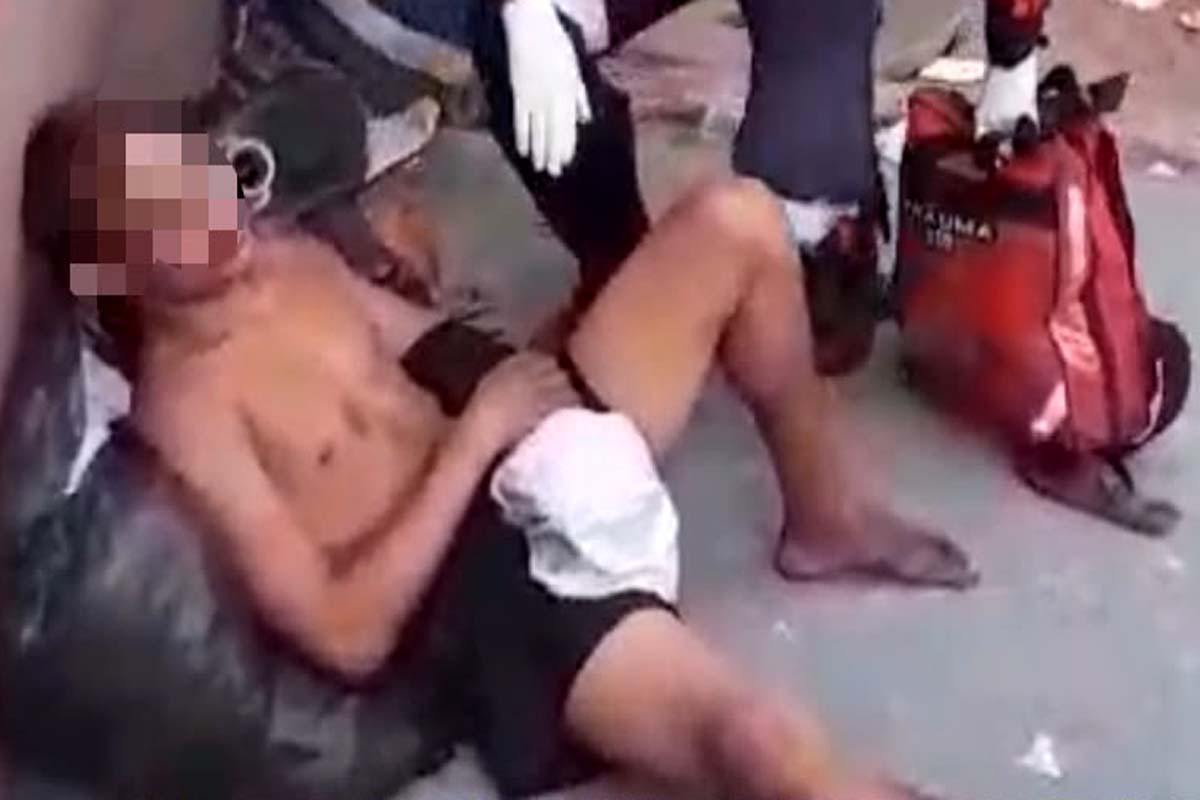 Morador de rua tem os dois braços quebrados durante espancamento