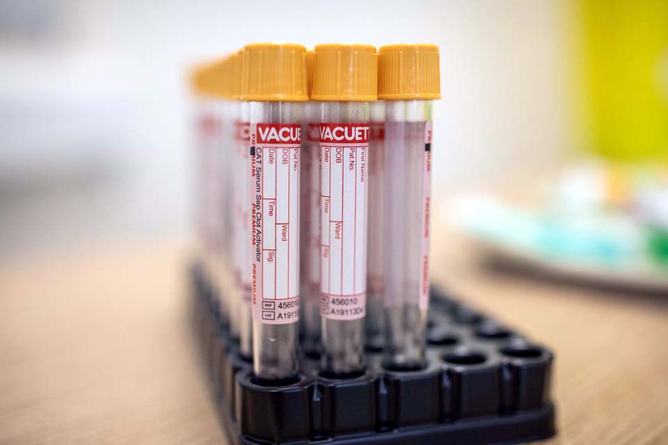 Estado de São Paulo registra mais de 330 mil casos de covid-19