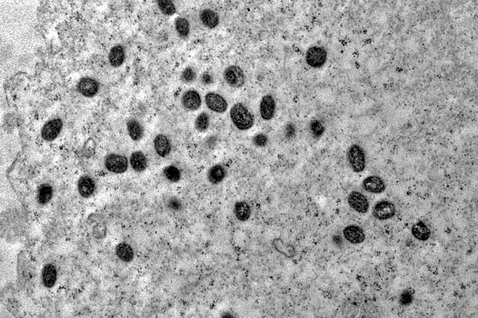 Mpox ainda é problema de saúde pública, dizem especialistas da Fiocruz