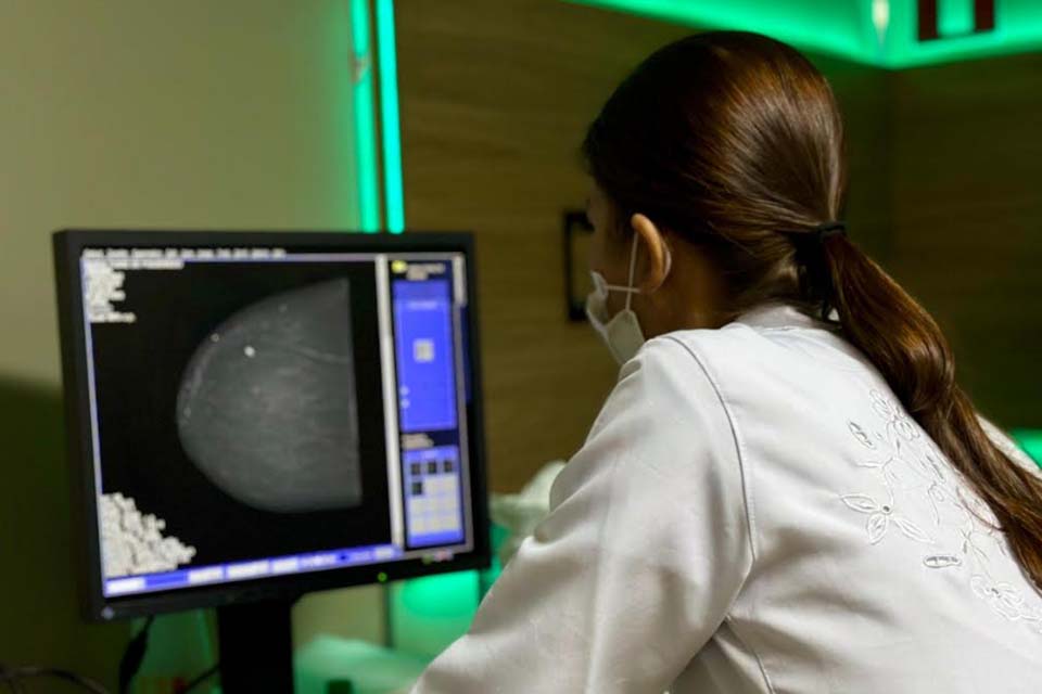 Mais de 600 procedimentos foram realizados durante atendimentos da Unidade Móvel do Hospital do Amor em Jaru