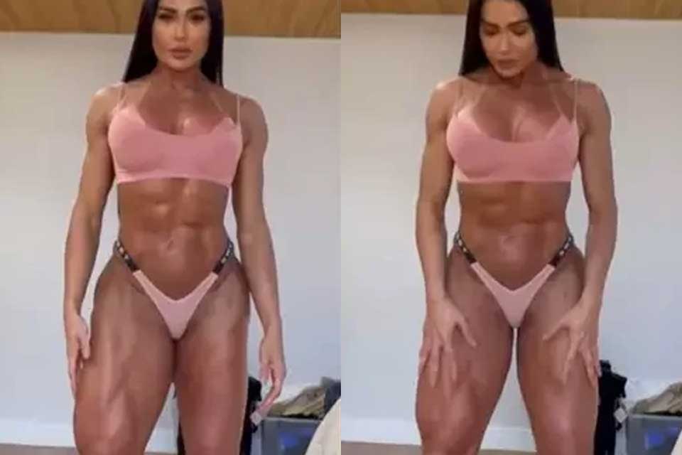 Gracyanne Barbosa mostra diferença entre as pernas após cirurgia: “Zero preocupação com estética”