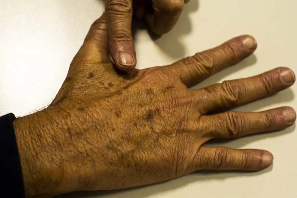 Instituto Nacional do Câncer manifesta apoio a imposto seletivo sobre bebidas alcoólicas