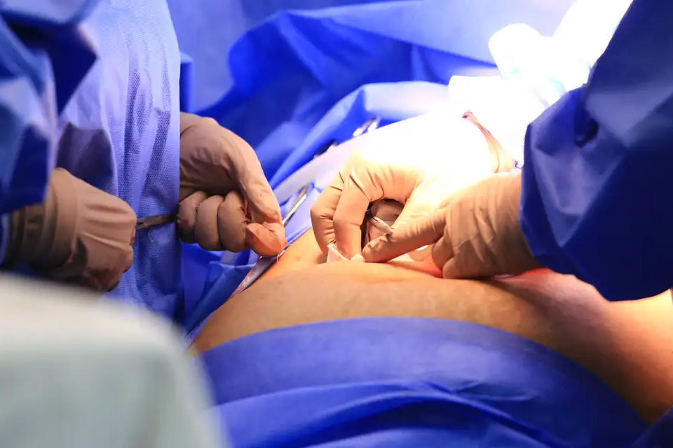 Ministério da Saúde prevê zerar filas de cirurgias em cinco estados brasileiros