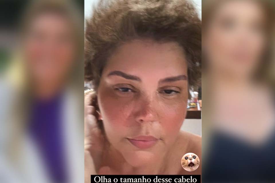 Simony mostra evolução do crescimento do cabelo após tratamento para câncer