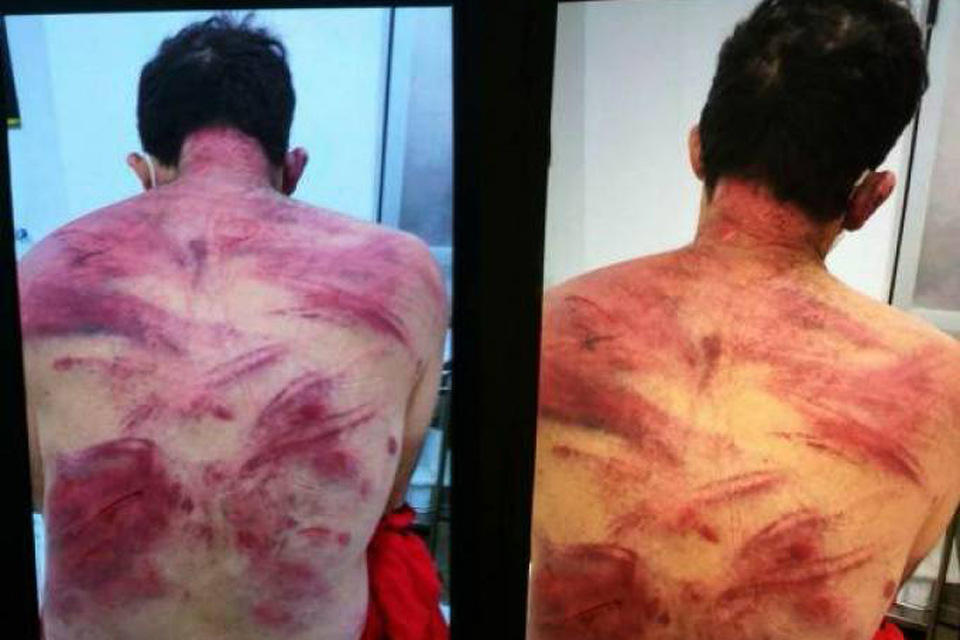 Imagens mostram homem que matou dentistas “todo arrebentado” na cadeia de Colorado