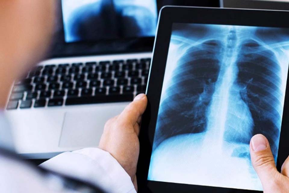 Prefeitura iniciará instalação do novo Raio-X digital na próxima segunda-feira, 09