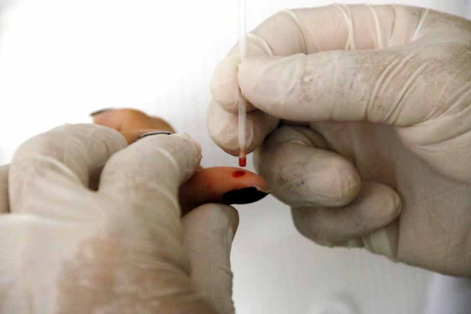 Governo de Rondônia garante diagnóstico rápido e tratamento gratuito contra malária e hepatites virais