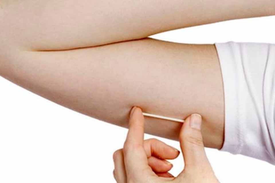 Prefeitura disponibiliza Implanon gratuitamente; método anticoncepcional dura três anos 